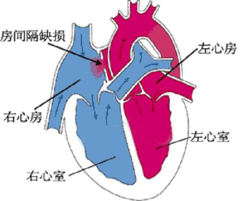 我们正常人的心脏有4个心腔:分别是左心房,右心房,左心室,右心室.