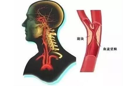 u=701692035,2869187972&fm=26&gp=0.jpg