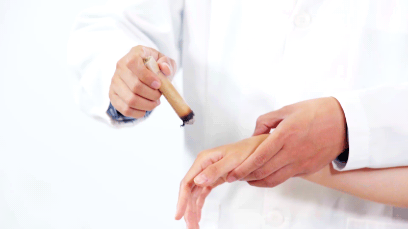 gif 艾灸疗法.gif