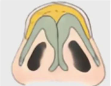 png 图片3.png