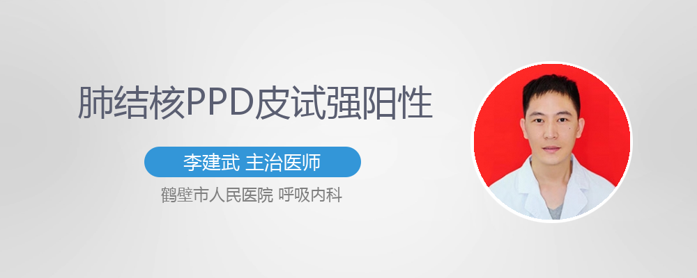 肺结核ppd皮试强阳性