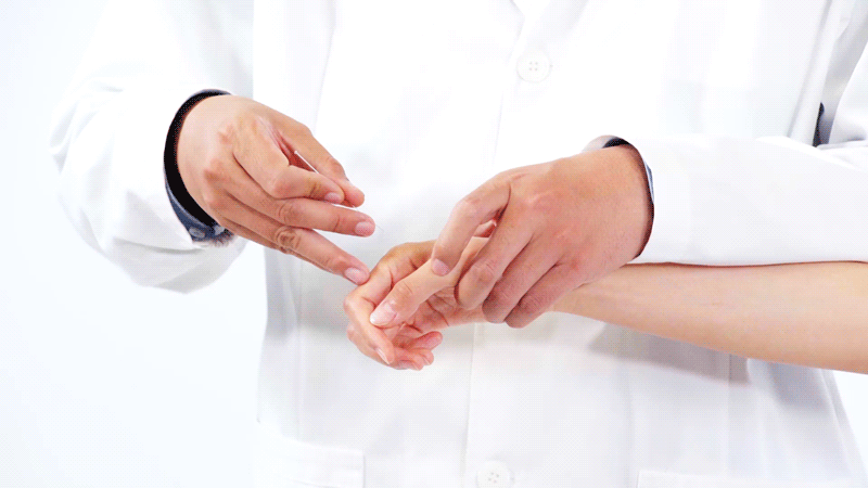 gif 针刺疗法.gif