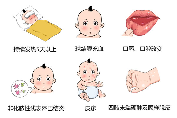 怎么预防血管炎 5380D43DEF28FFEFFBA1F8EA2FC1A5D3.jpeg
