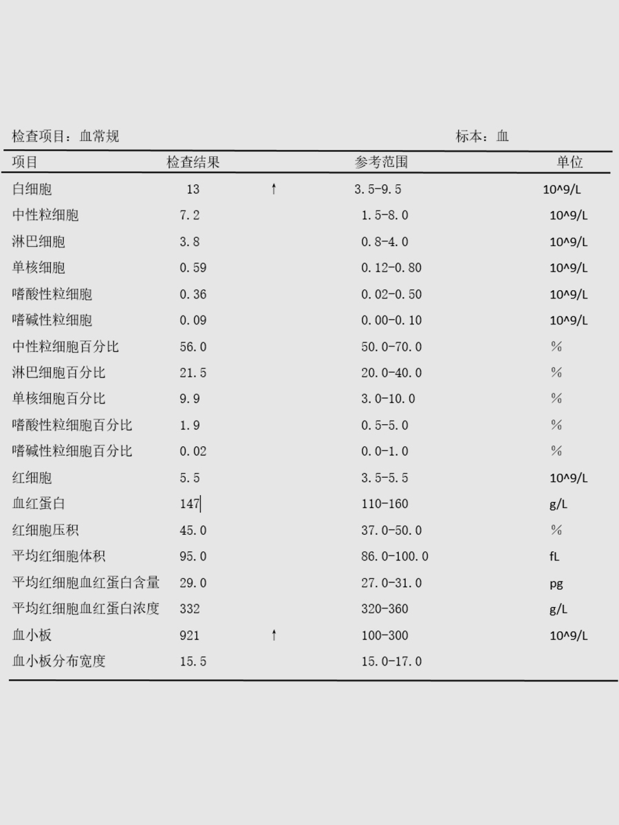 jpg 骨髓增殖性肿瘤(老年男子确诊血小板增多症易疲乏,药物治疗稳定病情!).jpg