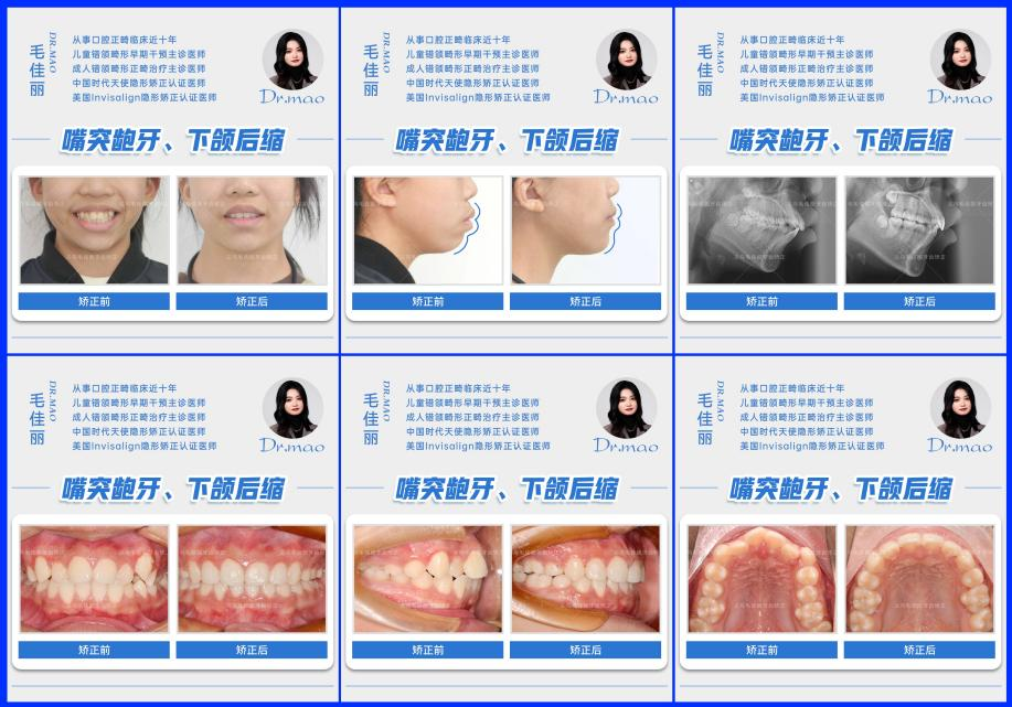 png 图片5.png