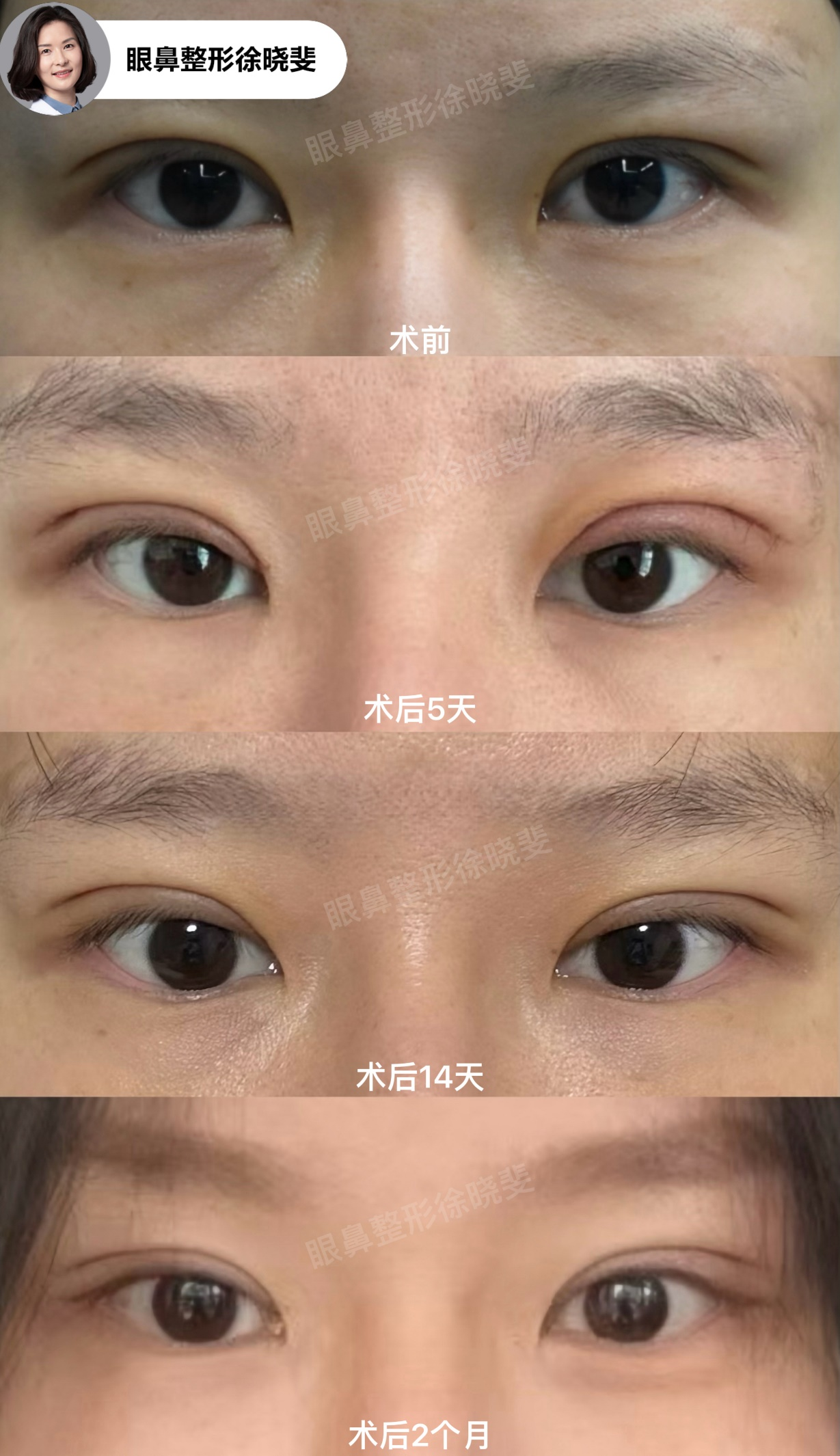 png 图片17.png