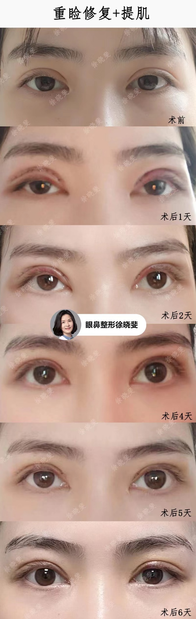 png 图片11.png