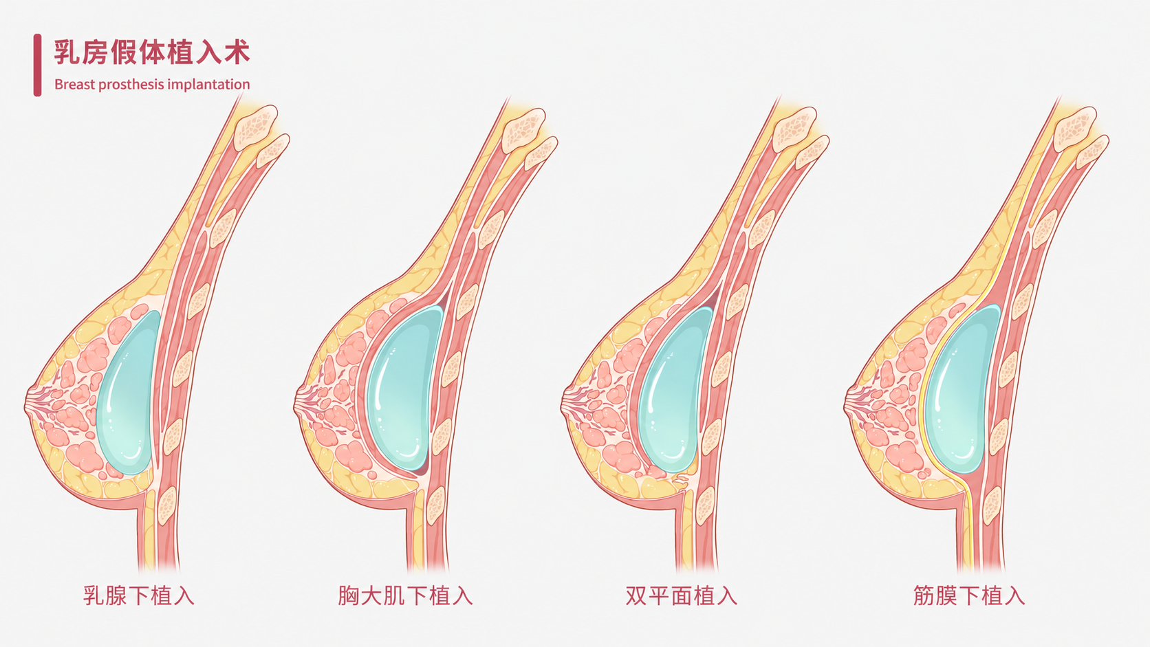 png 图片12.png