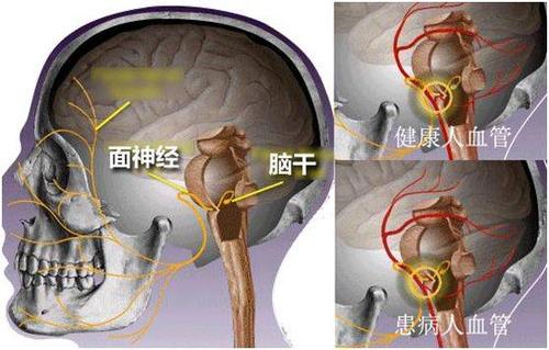 u=26731042,2259737784&fm=15&gp=0.jpg