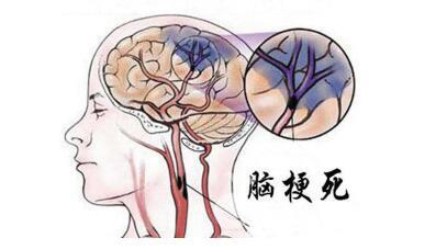 下载 (5).jpg