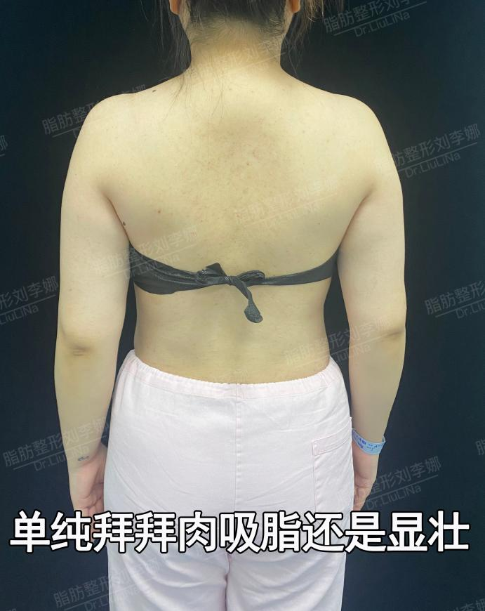png 图片10.png
