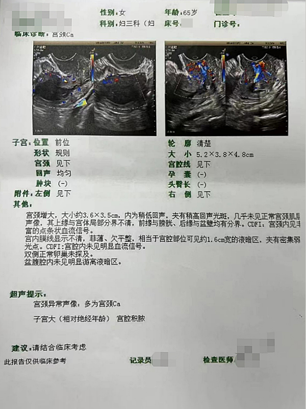 宮頸癌2.jpg