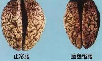 u=4101376198,1527096102&fm=26&gp=0.jpg