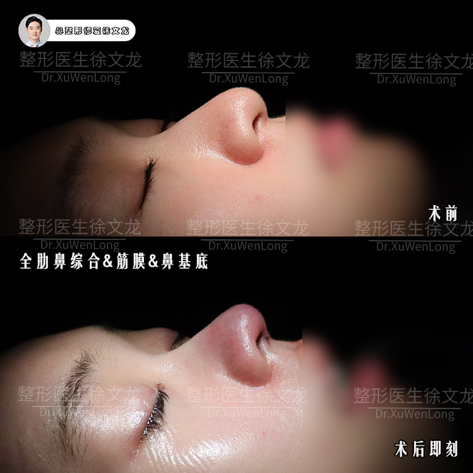 png 图片4.png