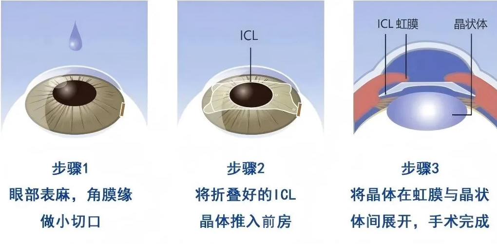 png 55555.png