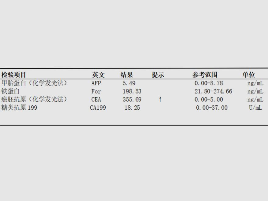 png 付振明-肺鳞癌(老大爷确诊肺鳞癌,化学药物治疗助其抑制病情进展).png