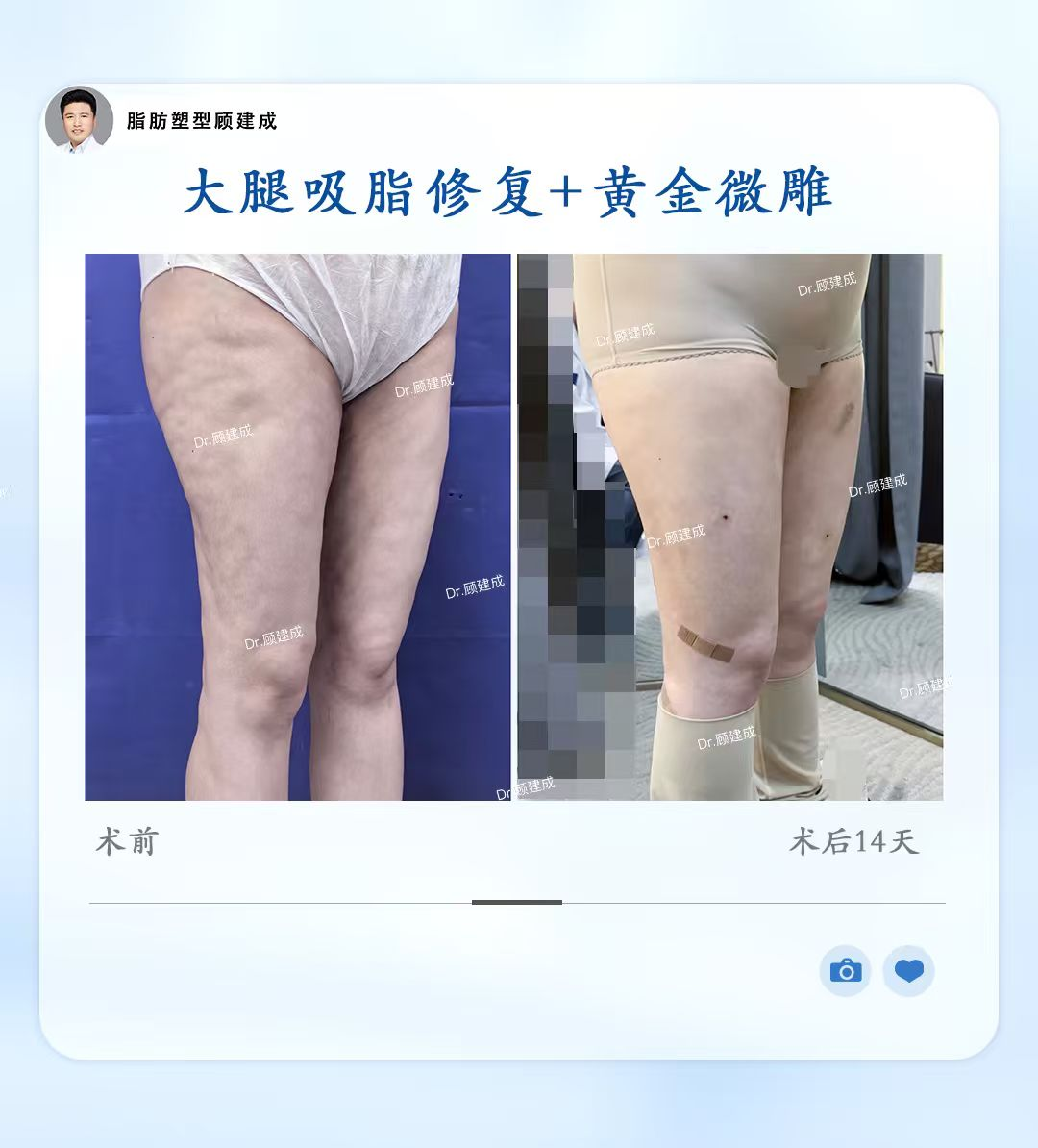 png 图片2.png