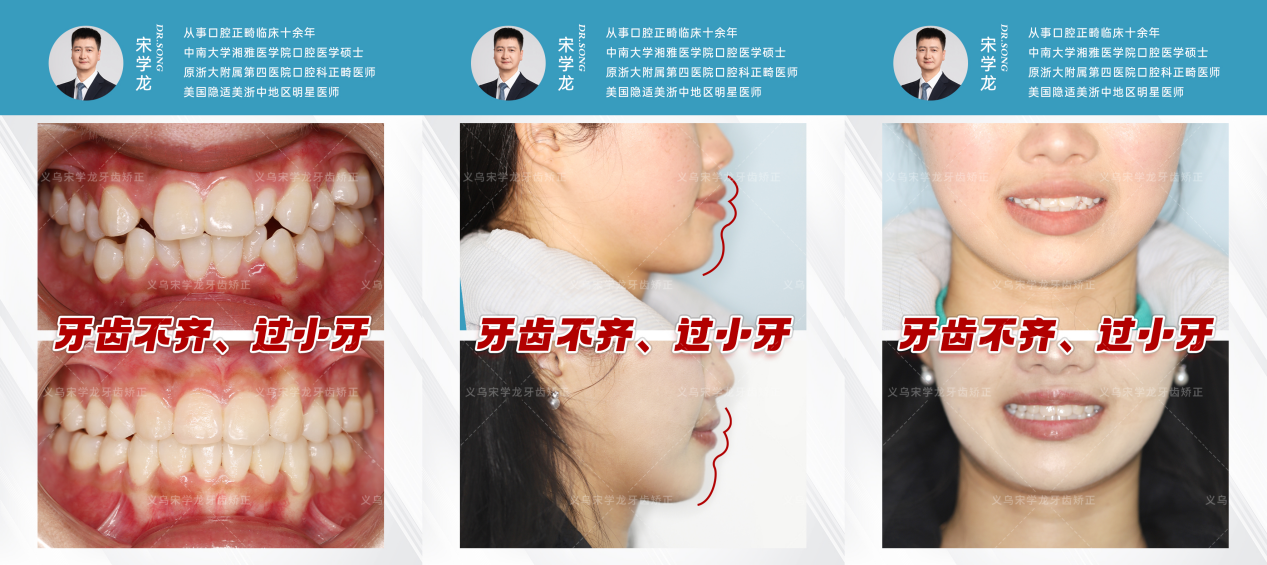 png 图片4.png