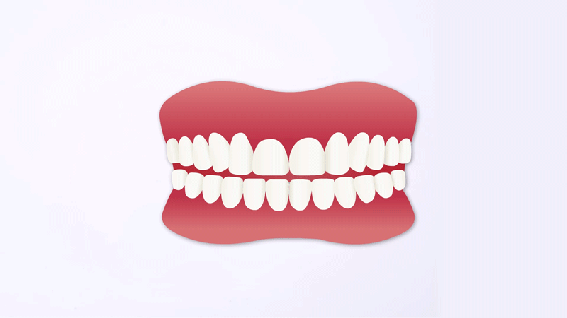 gif 实施手术.gif