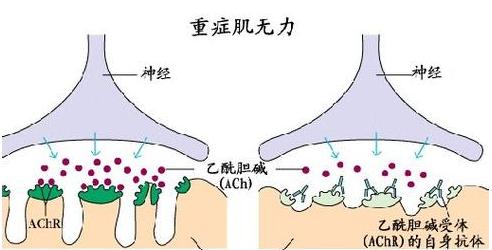 下载 (4).jpg
