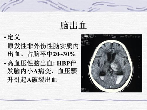 u=841969212,676186758&fm=26&gp=0.jpg