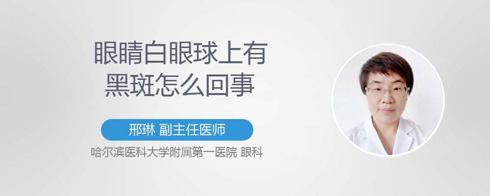 眼睛白眼球上有红血丝怎么回事