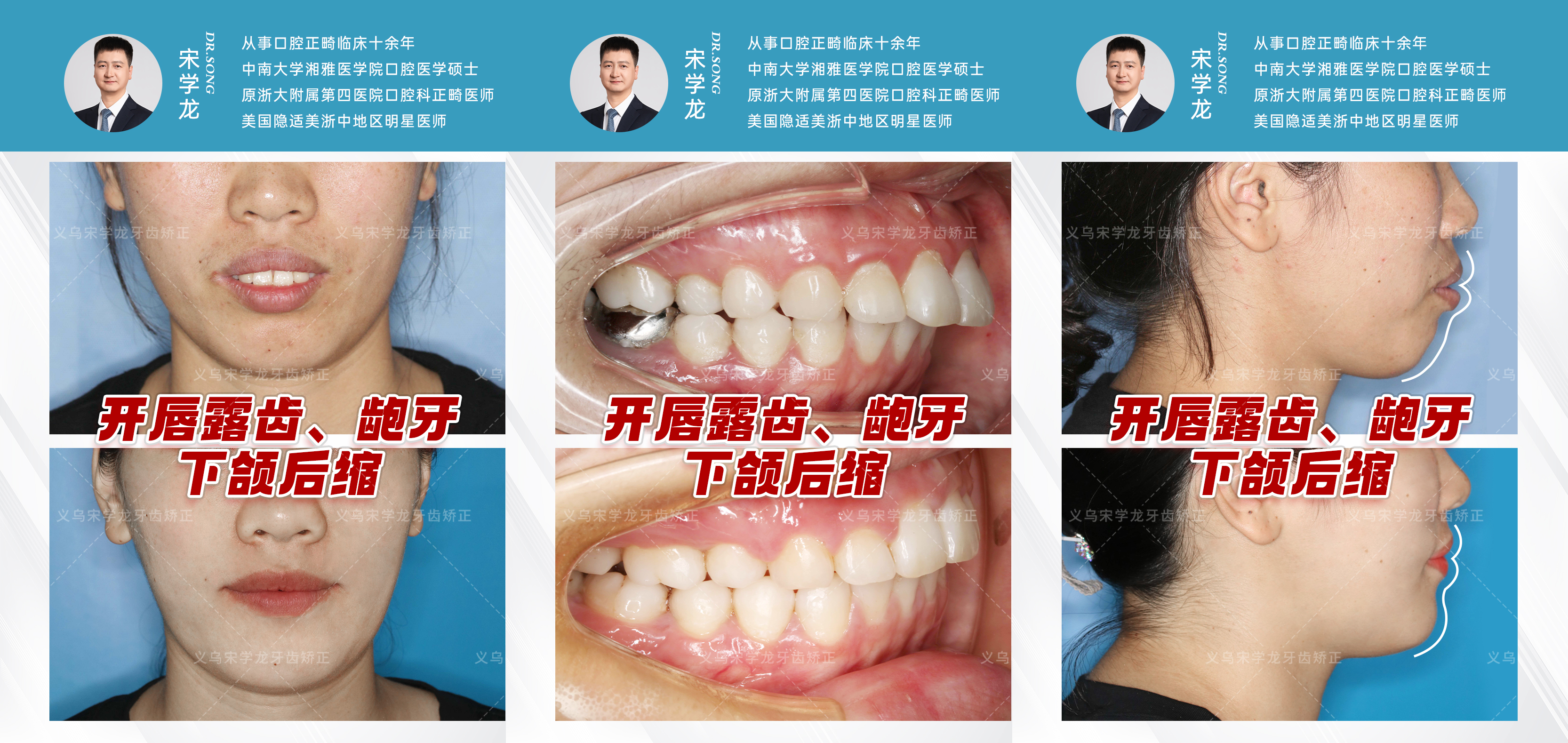 png 图片3.png