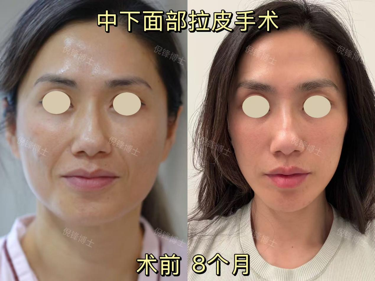 png 图片25.png