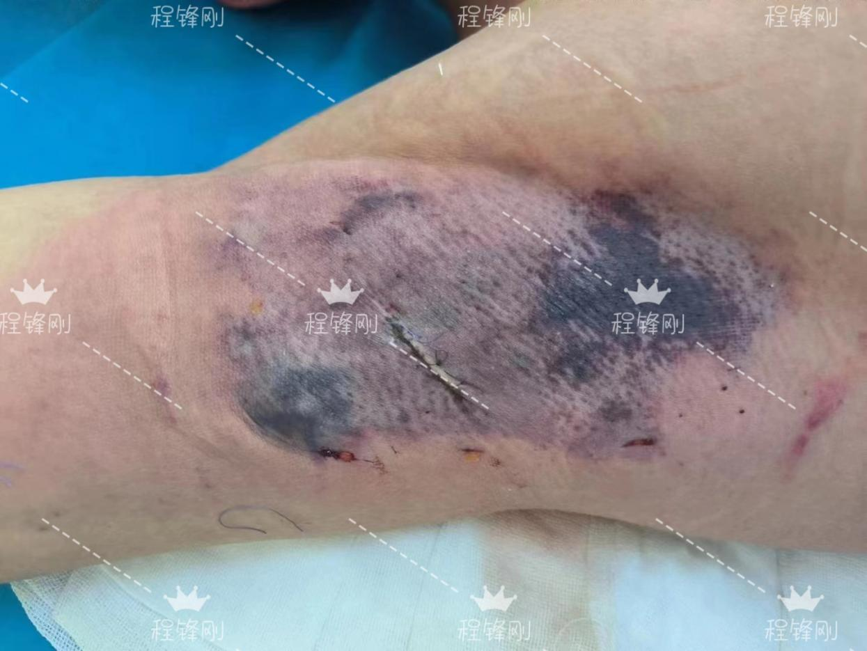 png C7E4BCDC5B2C8B9169FF60BB578CE408.png