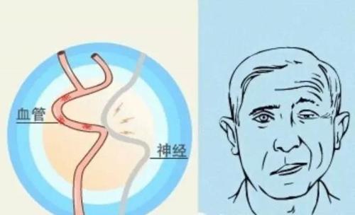 jpg u=3343919990,3585771059&fm=26&gp=0.jpg