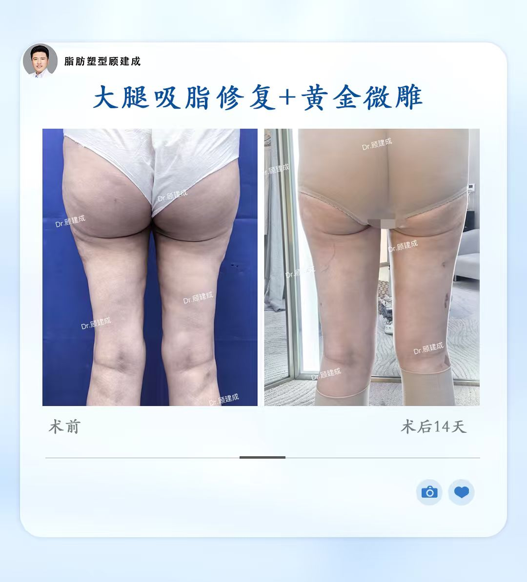 png 图片5.png
