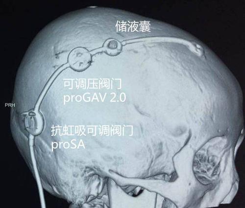u=3088897076,2418620519&fm=26&gp=0.jpg