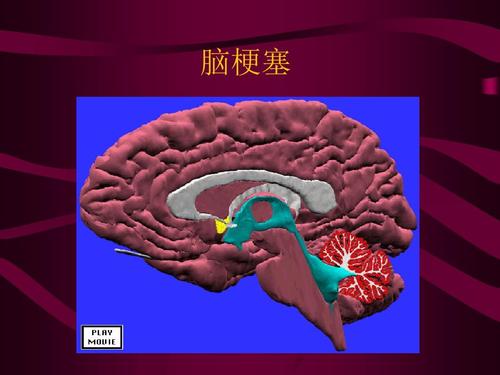 u=1762412156,3080047289&fm=26&gp=0.jpg