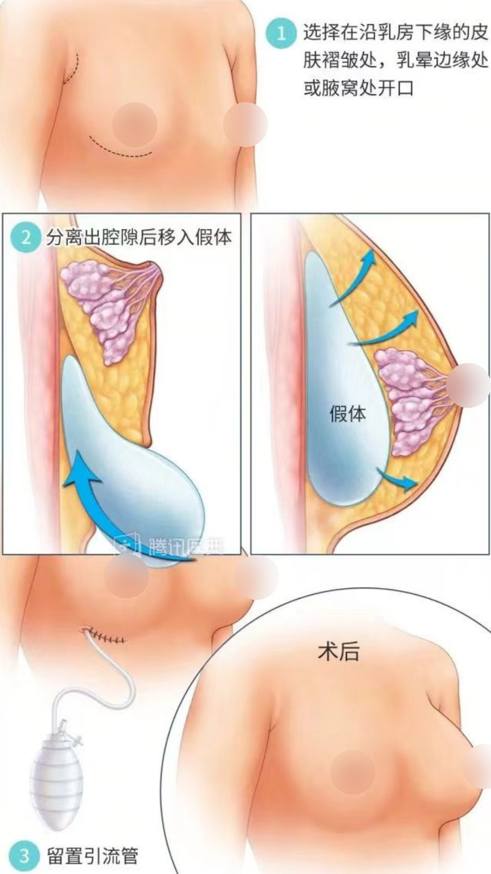 png 图片44.png
