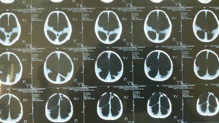 jpg u=1778985395,4069769614&fm=26&gp=0.jpg