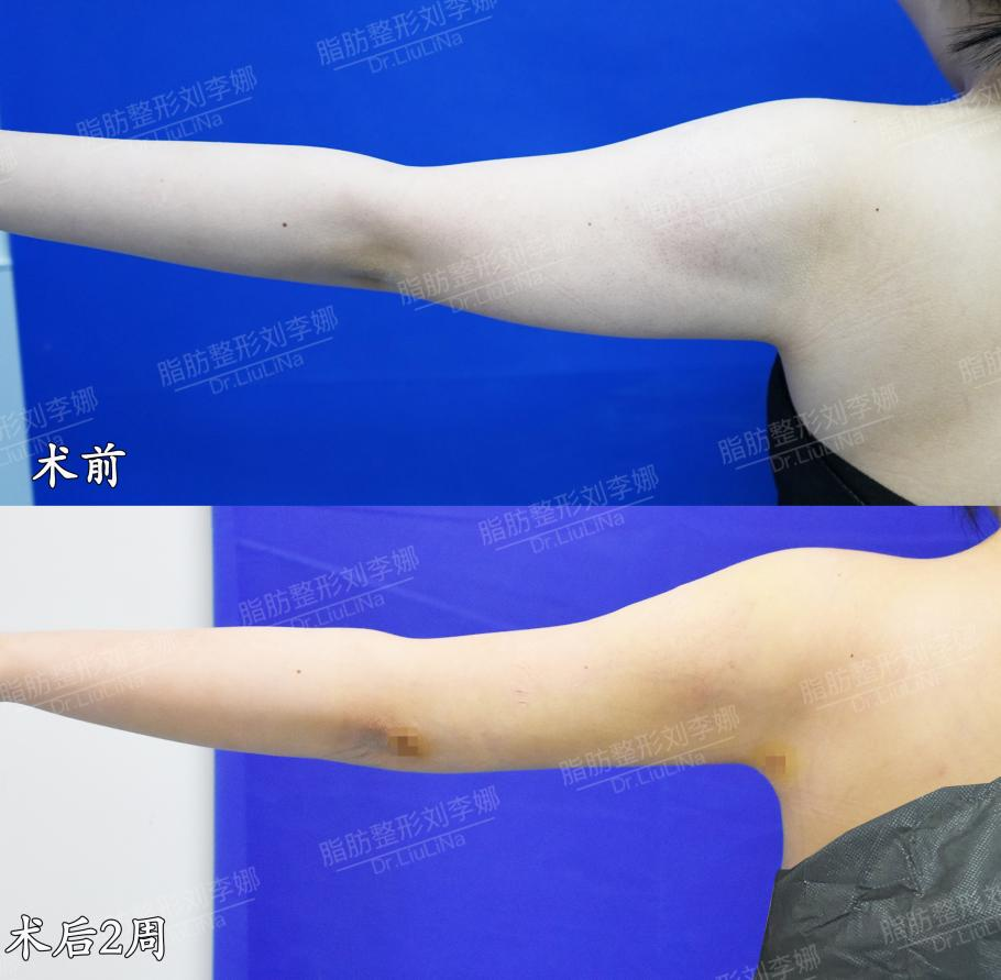png 图片14.png