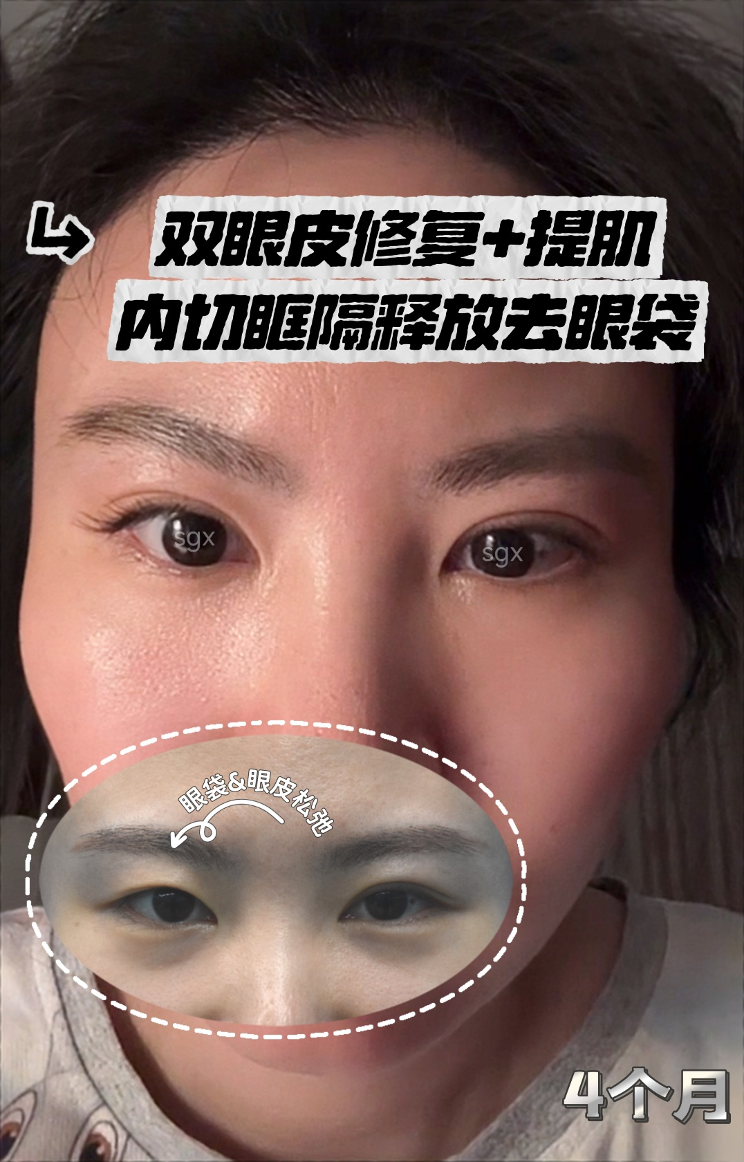 png 图片3.png