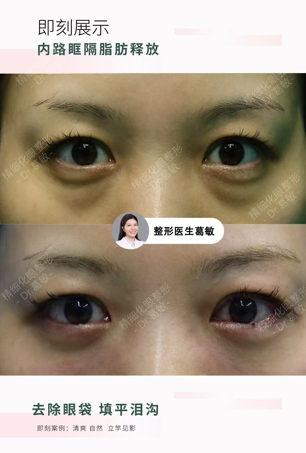 png 图片7.png