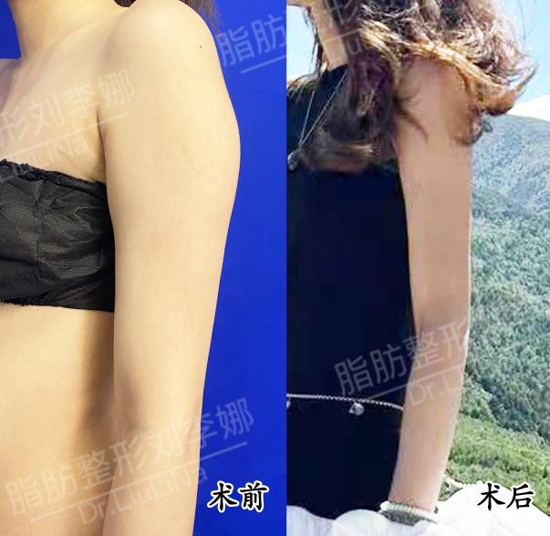 png 图片15.png