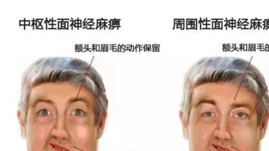 u=1469843156,3583296440&fm=26&gp=0.jpg