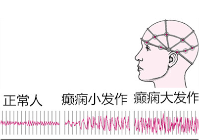 u=2611140655,2137843073&fm=26&gp=0.jpg