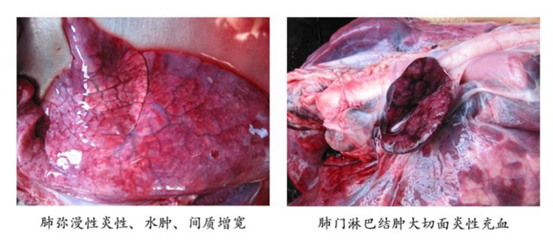 颈部切面淋巴结肿大图片