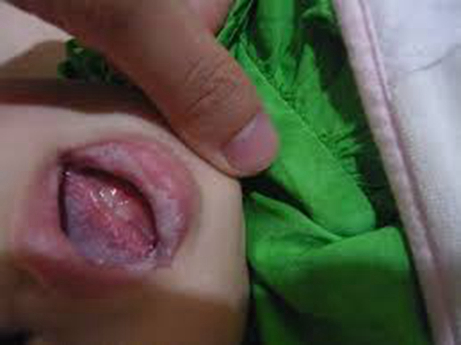 婴儿嘴唇奶泡图片图片