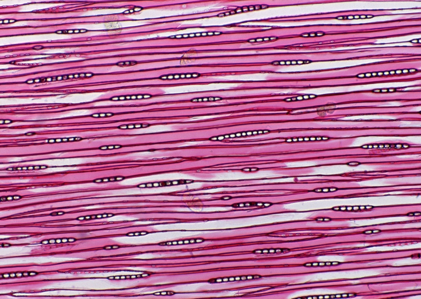 丝状疣细胞的图片