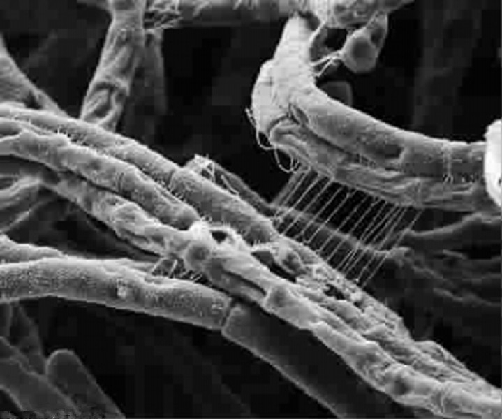 丝状疣显微镜下的图片