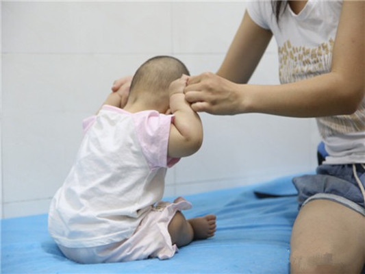 宝宝痉挛性斜颈的康复图片