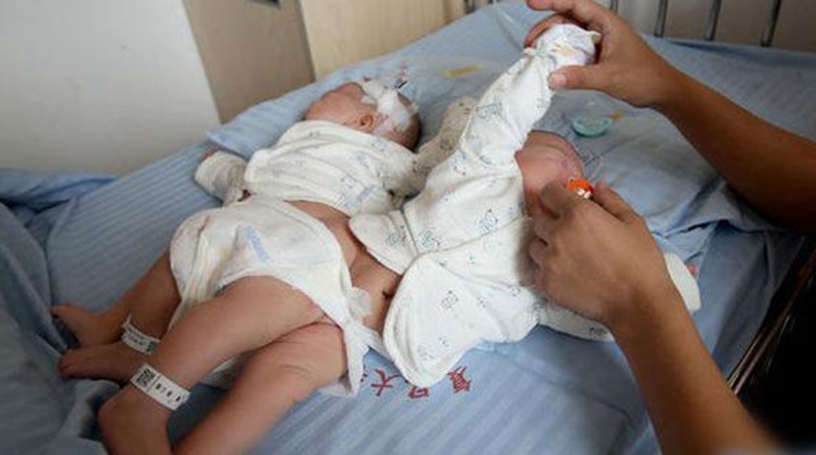男宝宝尿路感染的症状图片