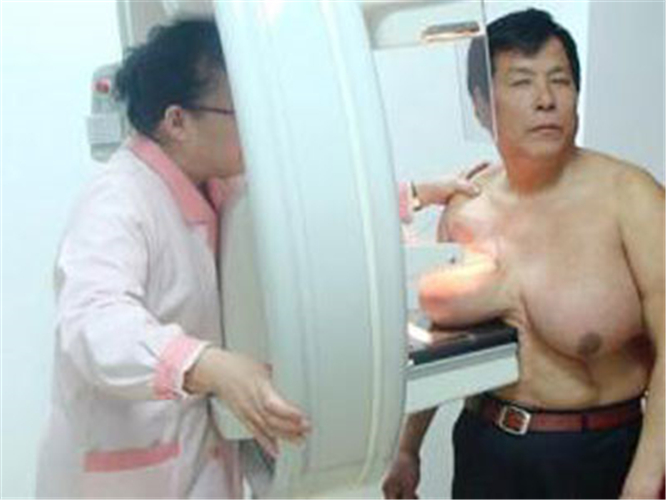 男性乳腺癌图片