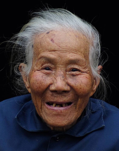长老年斑的白发奶奶图片