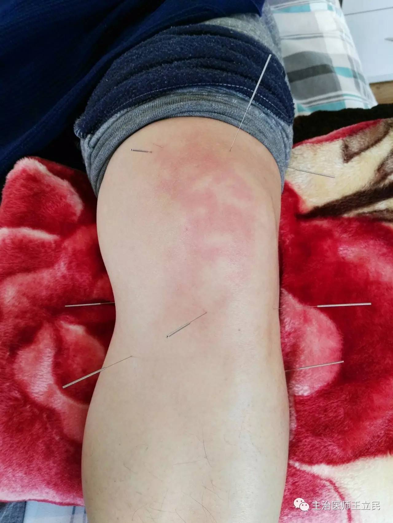 王立民的简介及出诊时间